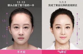 用线去脸毛视频